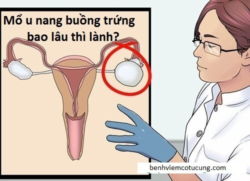 Mổ u nang buồng trứng bao lâu thì lành? 